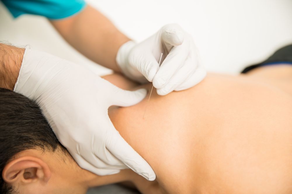 Hormone Balancing with Acupuncture